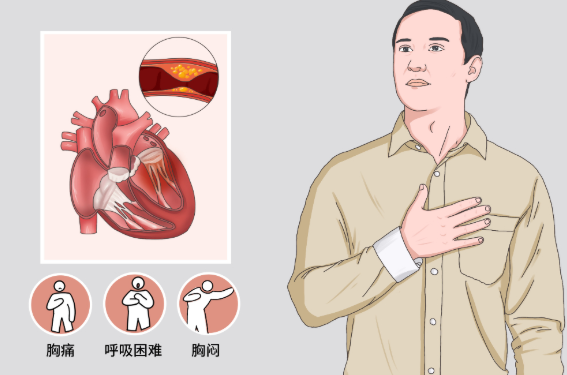 社康防治心血管，乐普闪链共行动~
